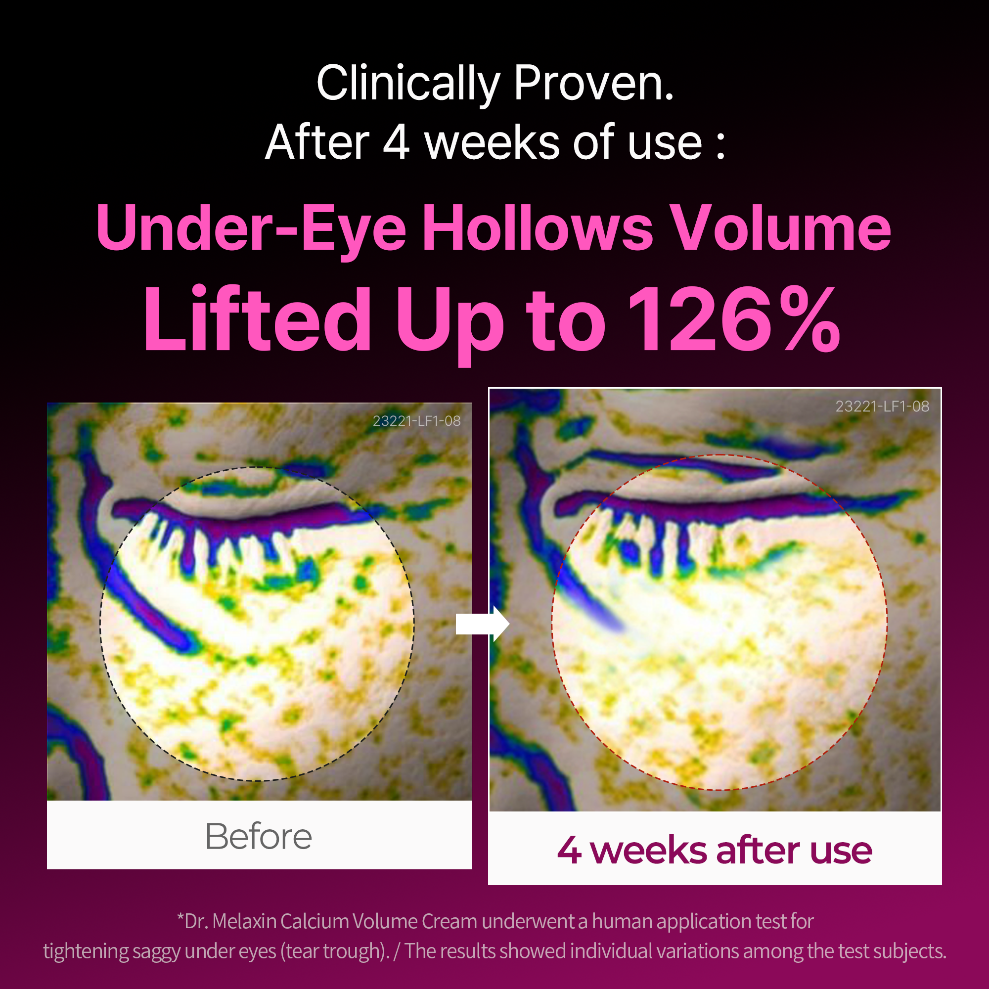 Calcium Intense Cream - image 2