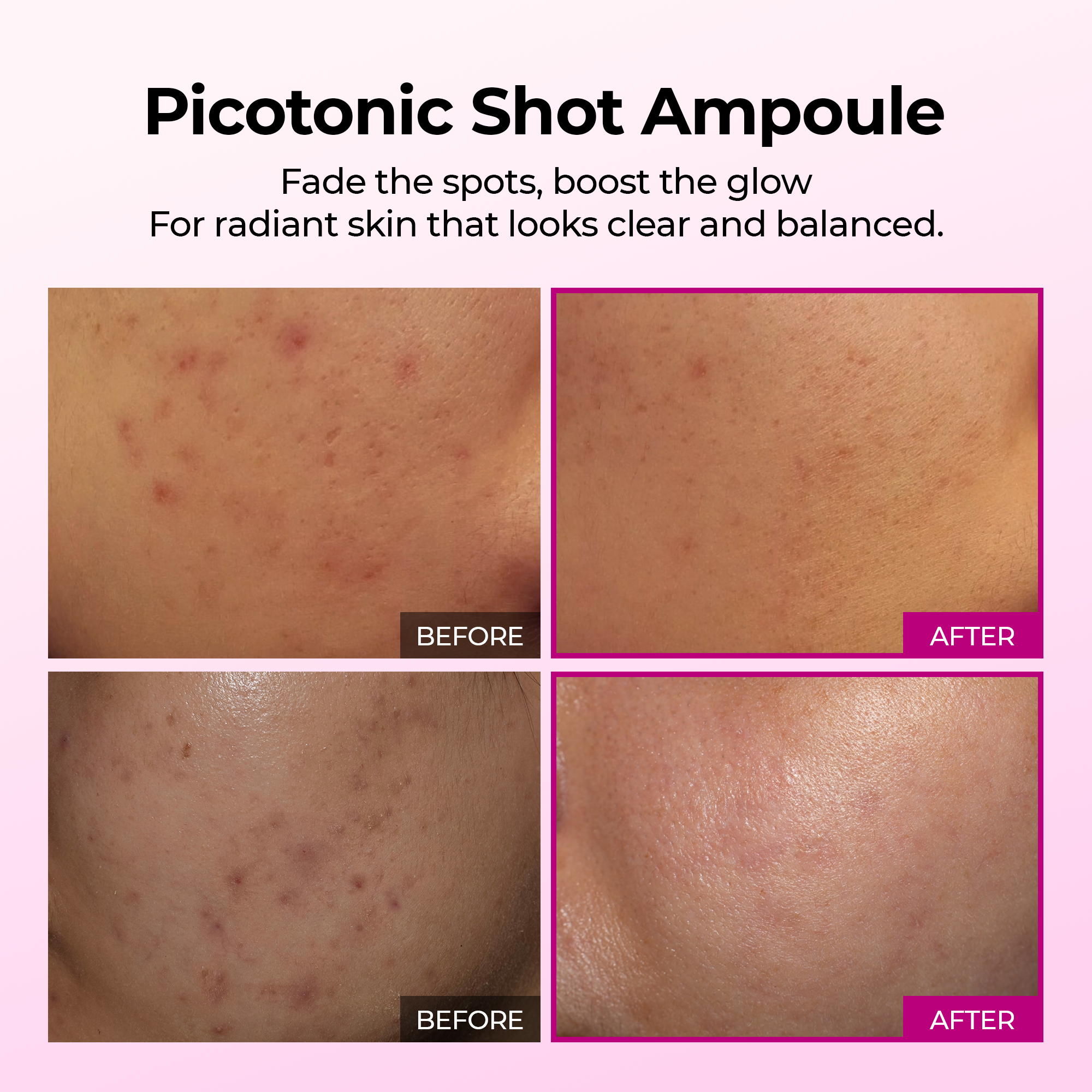 Picotonic Shot Pigmentation Ampoule - image 3