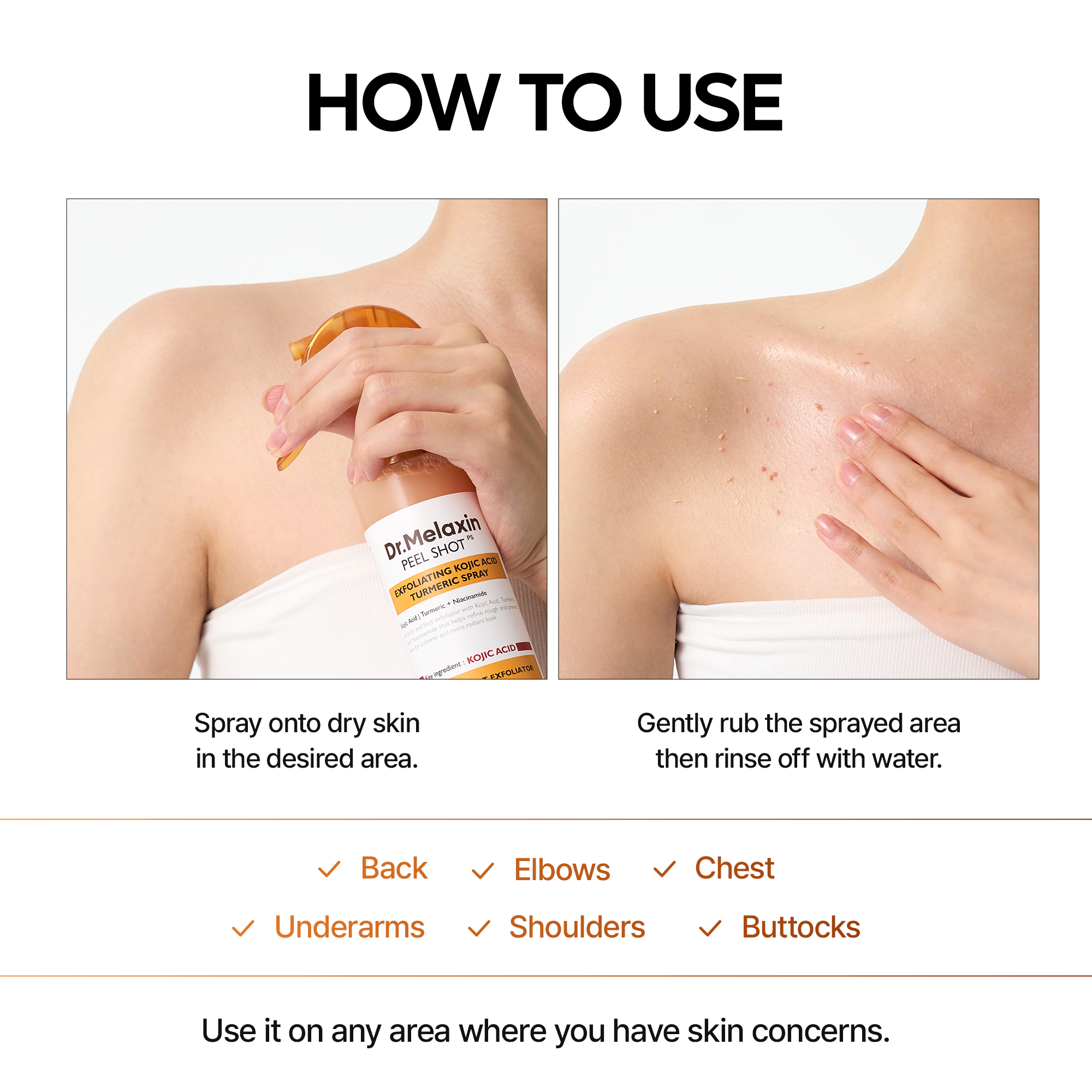 Peel Shot Kojic Acid Turmeric Spray - image 8