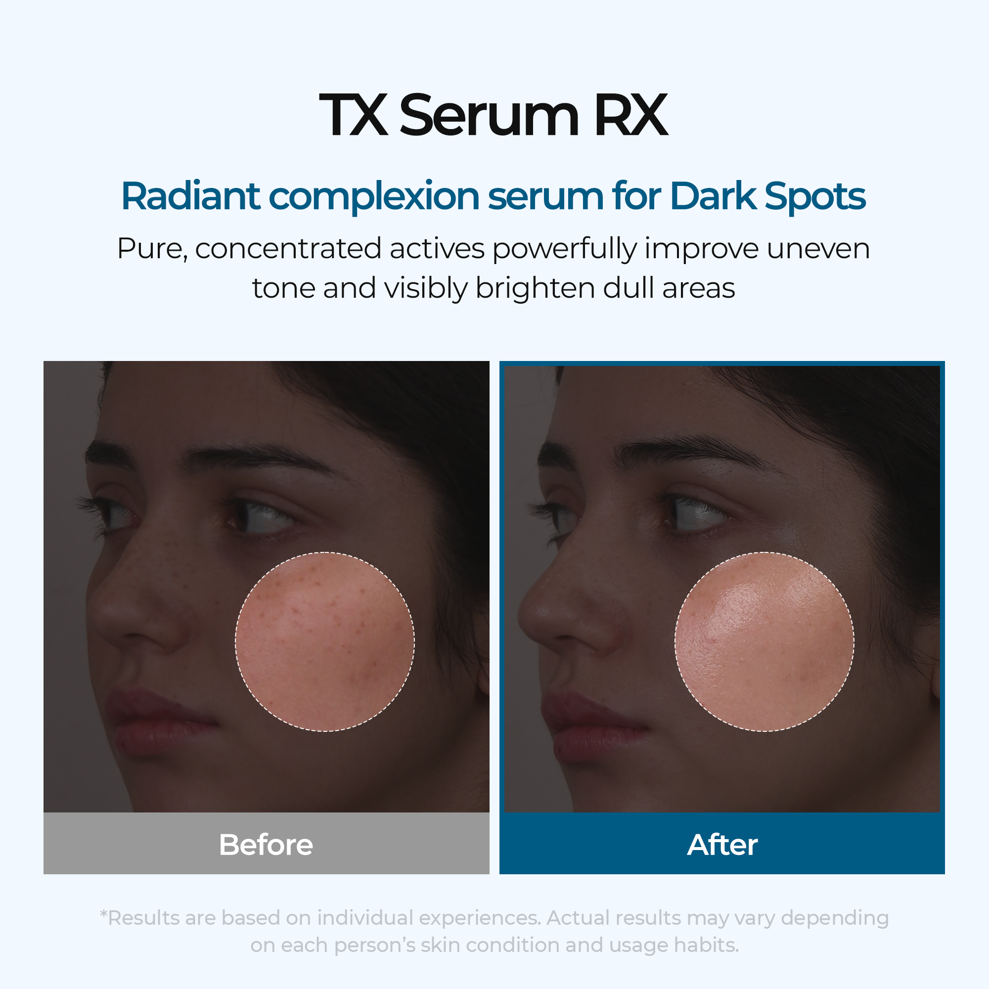 TX Ampoule Rx - image 2