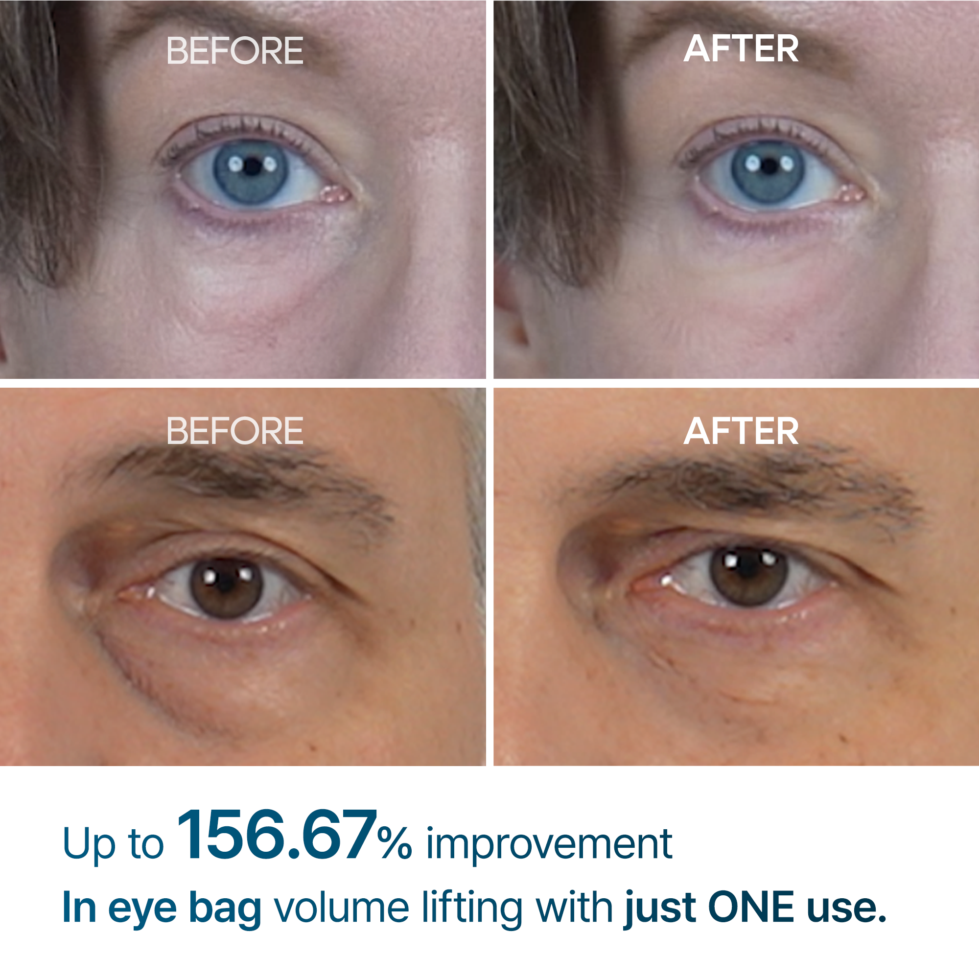 Eyephalt eyebag cream - image 3
