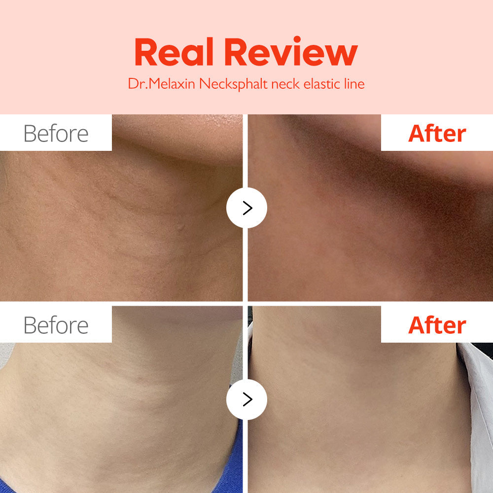 Necksphalt ECM Neck Tightening Line - image 4