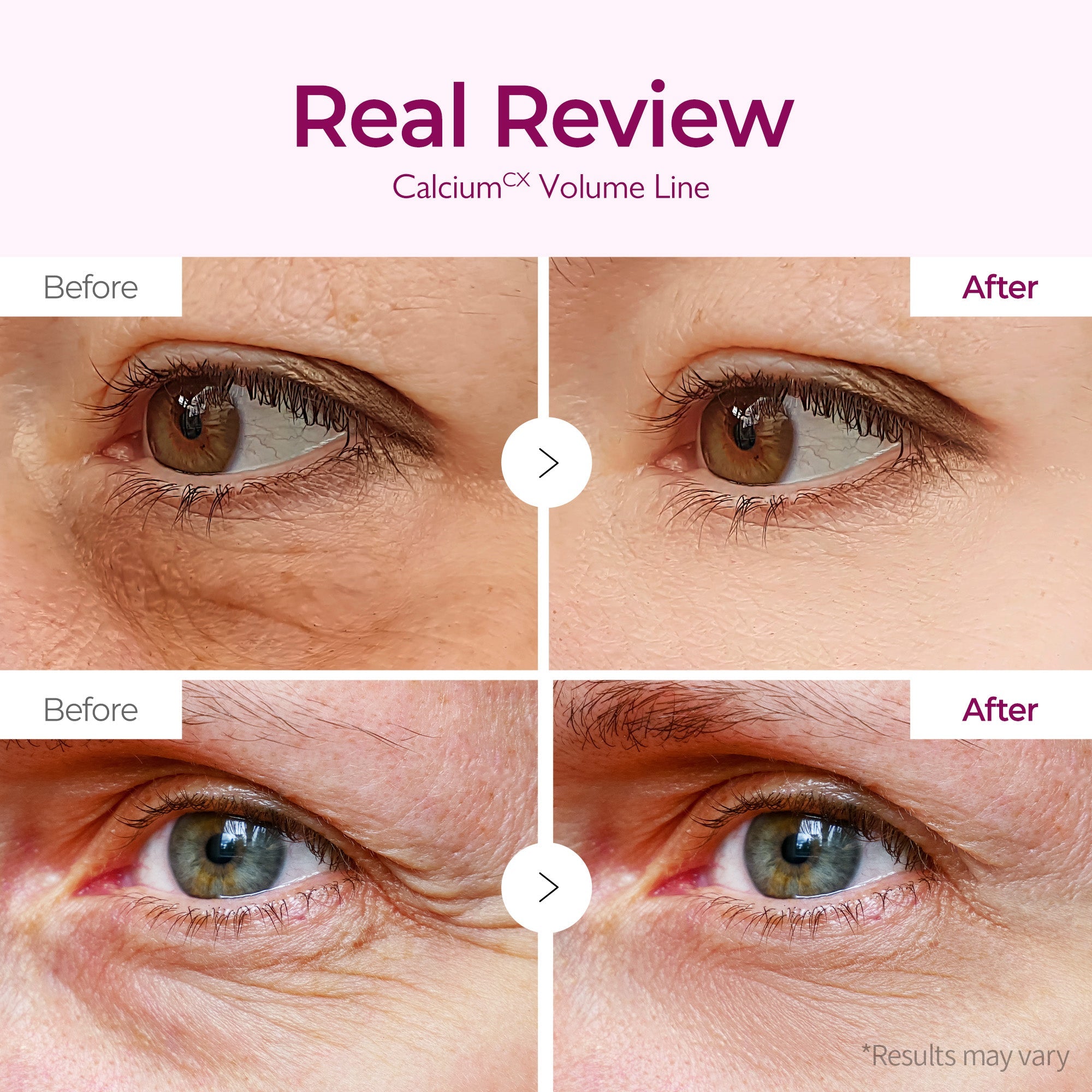 Calcium Bonding Eye Cream & Eye Patch 60ea - image 5