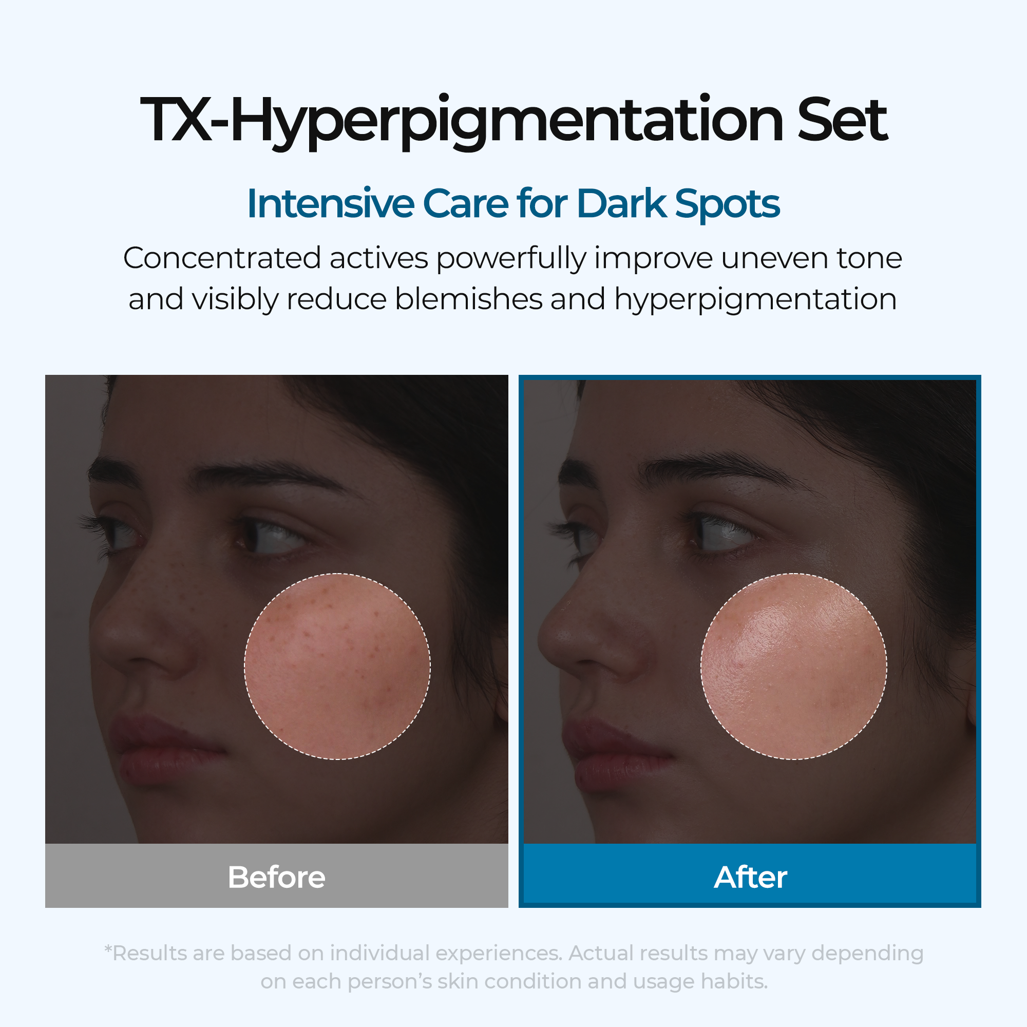 Dark Spot & Uneven Tone Peel Shot TX Duo - image 3