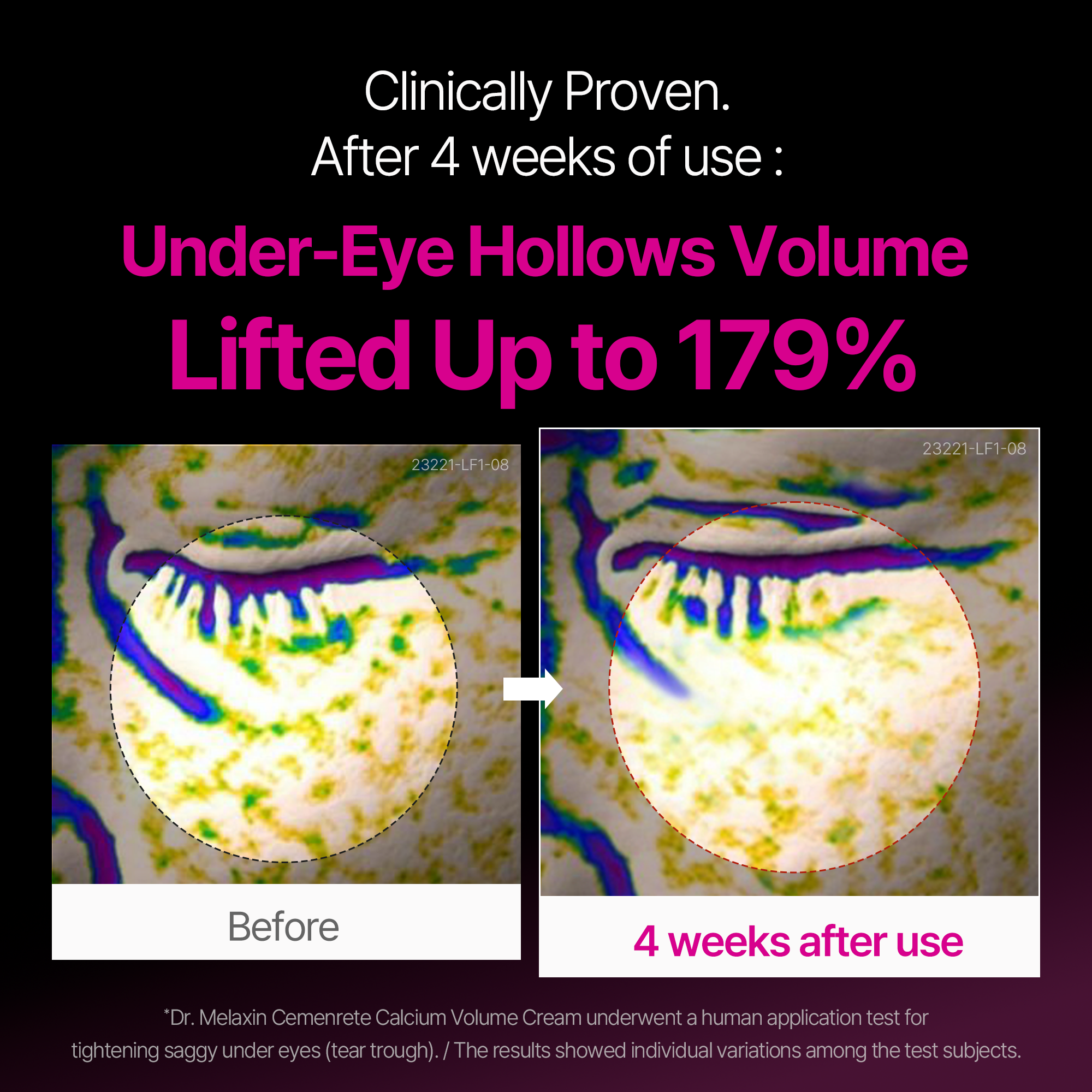 Calcium Eyecare Routine Set - image 2