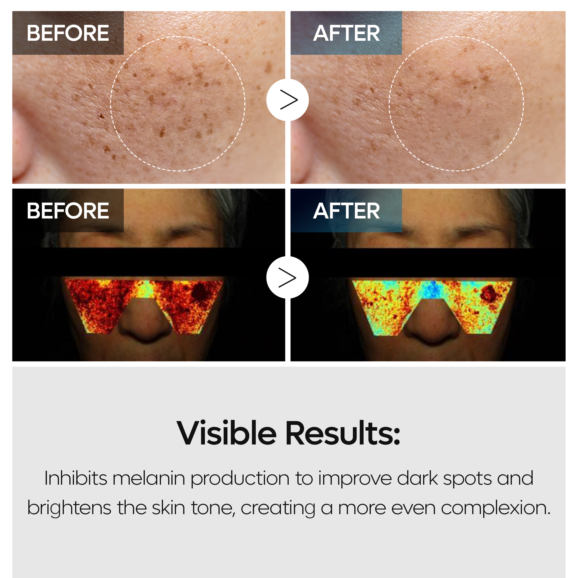 TX Tranexamic Acid Dark Spot Care Line - image 4