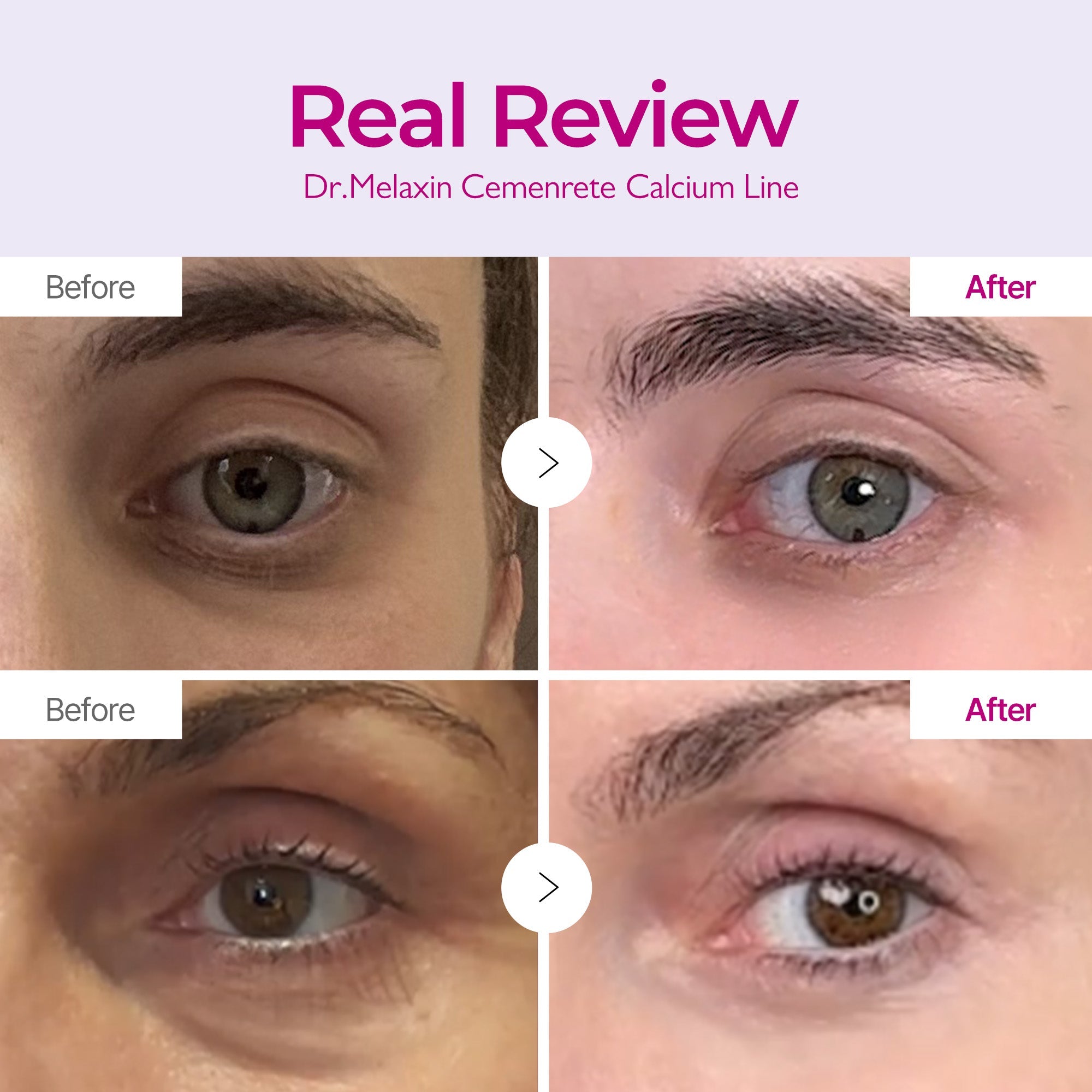 Cemenrete Calcium Intense Ampoule - image 4