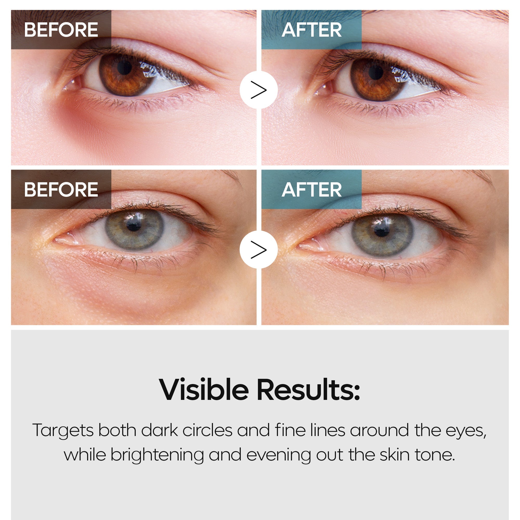 TX Retinalsome Eyecream 40g 1EA - image 5
