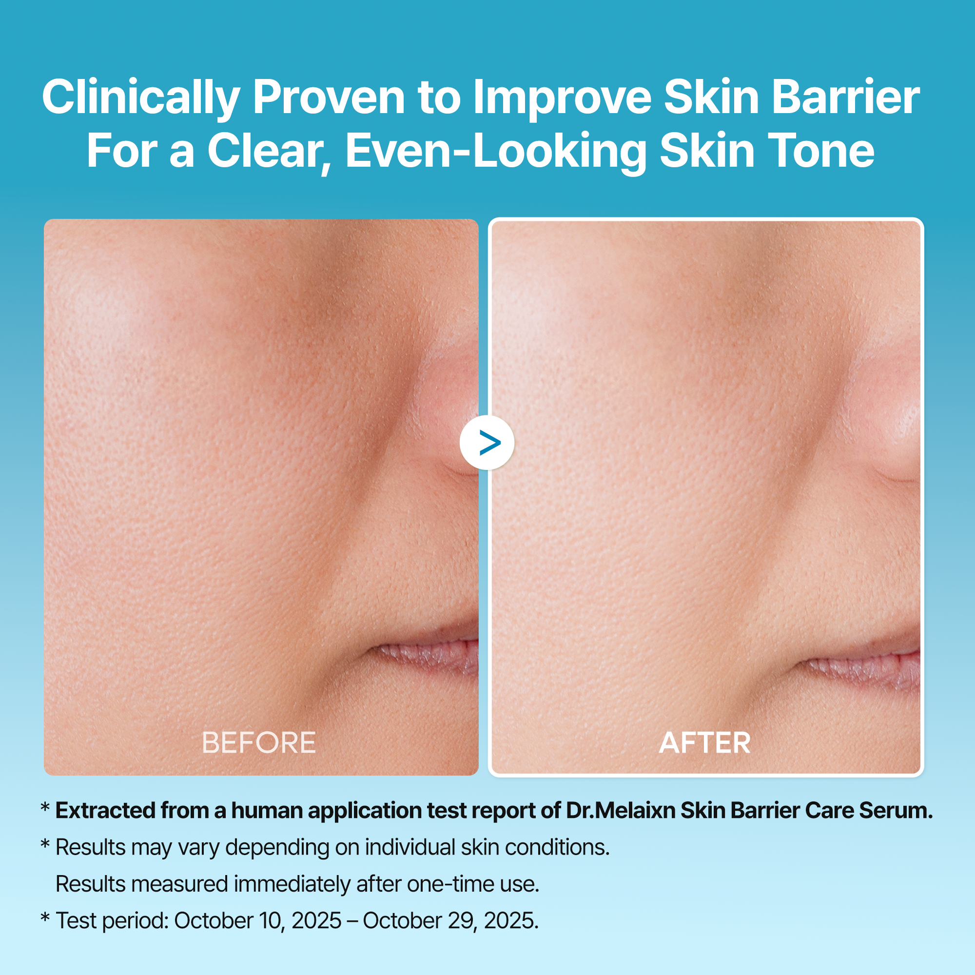 Peel Shot Exfoliating TX Serum - image 7